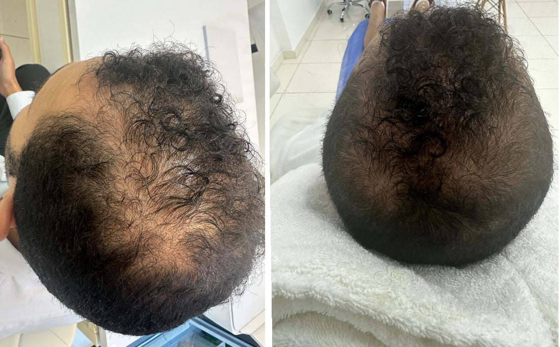 DQ Hair+ - Single vial