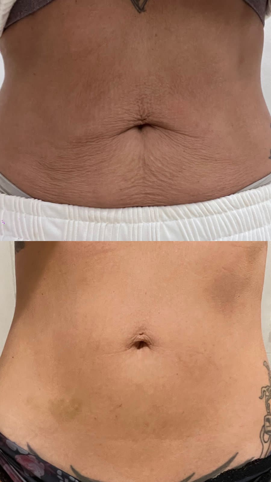 Tummy tightening with hydration 