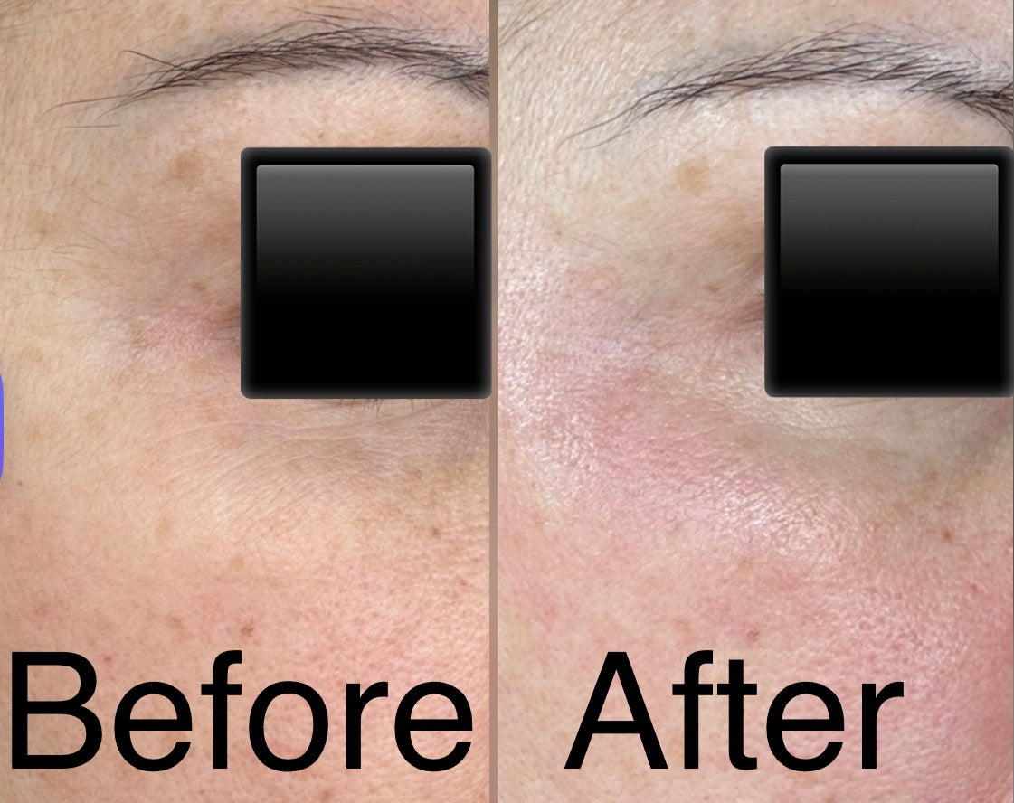 ghk cu face before and after Blue Booster GHK-Cu | Copper Peptide Skin Regeneration